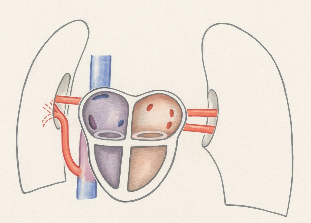 picture of heart and lungs pumping
